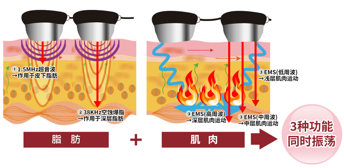 Naris Cavi 3S PRO(Naris Cavi 3S Pro)气蚀功能